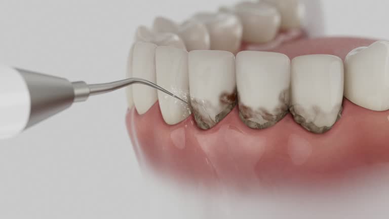 Trusted Tooth Extraction service in San Andreas, CA - Dentist Open Now
